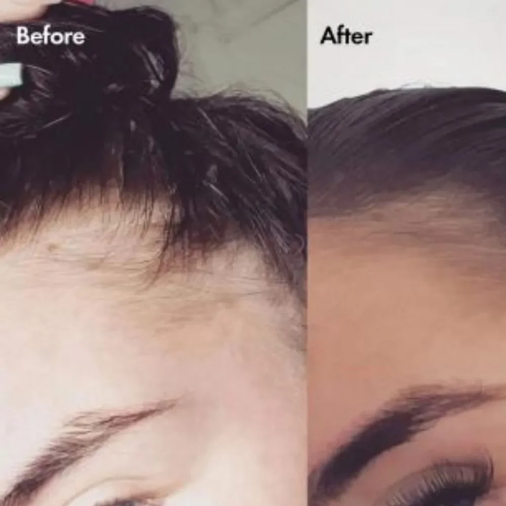 BondiBoost‎ Grow Getter Haircare Kit For Thinning Hair